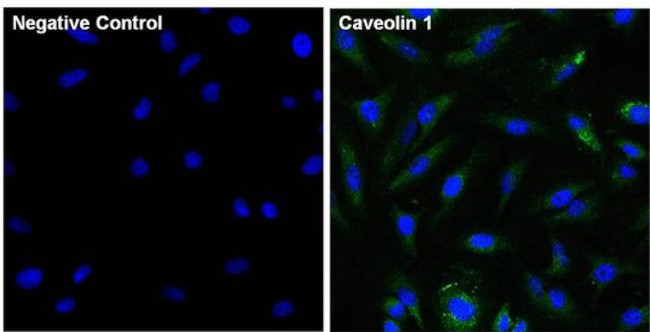 Caveolin 1 Antibody in Immunocytochemistry (ICC/IF)