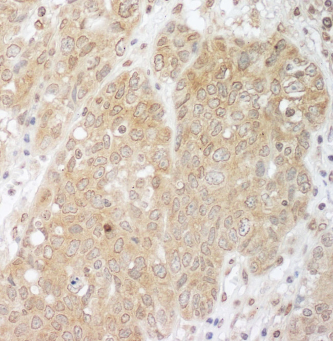 Cbl-b Antibody in Immunohistochemistry (IHC)