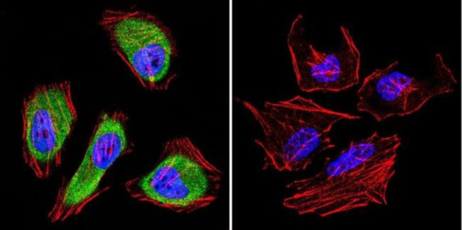 Cdc37 Antibody in Immunocytochemistry (ICC/IF)