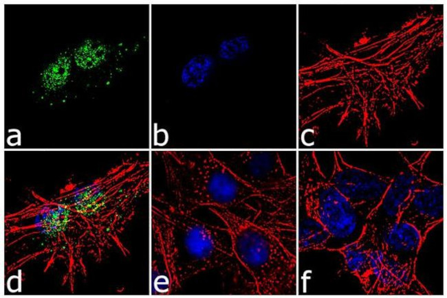 FOXG1 Antibody in Immunocytochemistry (ICC/IF)