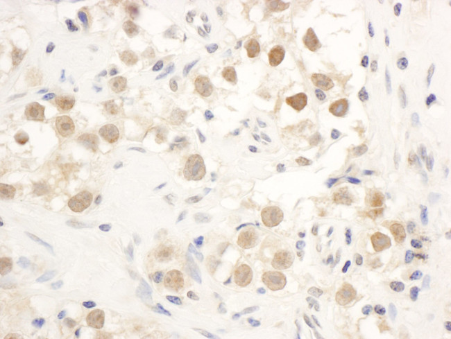 Chk1 Antibody in Immunohistochemistry (IHC)