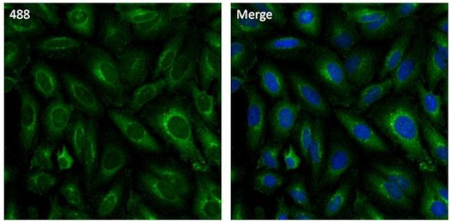 Clathrin Heavy Chain Antibody in Immunocytochemistry (ICC/IF)