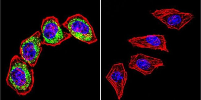 Clathrin Heavy Chain Antibody in Immunocytochemistry (ICC/IF)