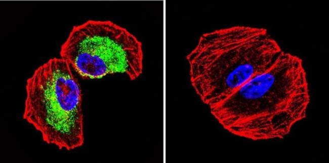 Clathrin Heavy Chain Antibody in Immunocytochemistry (ICC/IF)