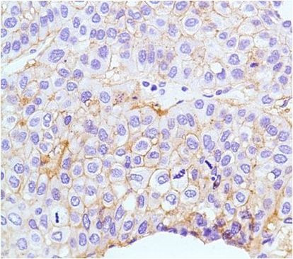 Claudin 1 Antibody in Immunohistochemistry (Paraffin) (IHC (P))