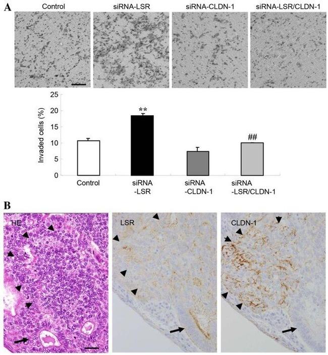 Claudin 1 Antibody in Immunohistochemistry (IHC)