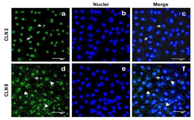 Claudin 2 Antibody in Immunocytochemistry (ICC/IF)