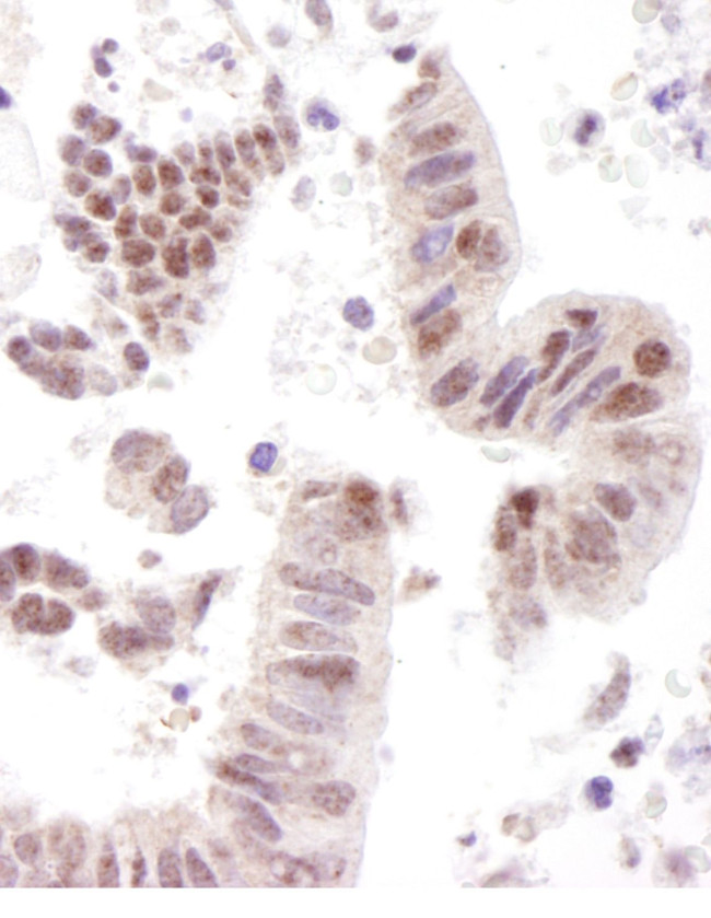 CoAA Antibody in Immunohistochemistry (IHC)