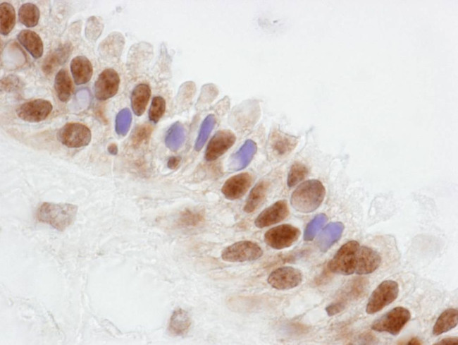 CoAA Antibody in Immunohistochemistry (IHC)