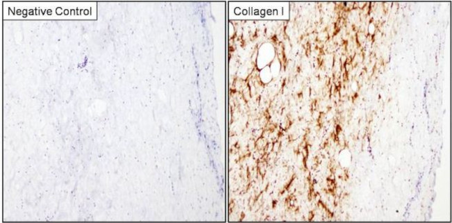 Collagen I Antibody in Immunohistochemistry (Paraffin) (IHC (P))