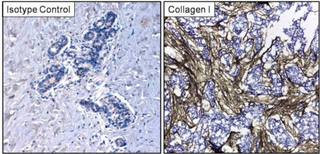 Collagen I Antibody in Immunohistochemistry (Frozen) (IHC (F))