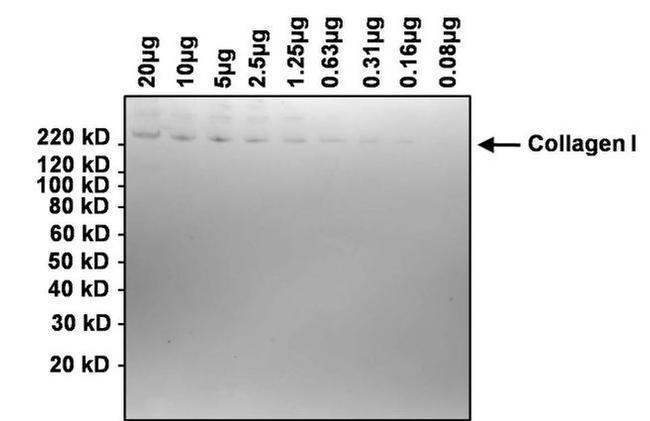 Collagen I Antibody in Western Blot (WB)