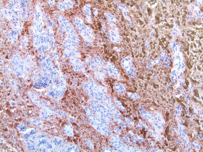 Collagen I Antibody in Immunohistochemistry (IHC)