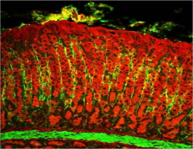 Collagen I Antibody in Immunohistochemistry (IHC)