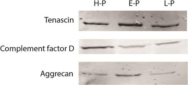 Aggrecan Antibody in Western Blot (WB)