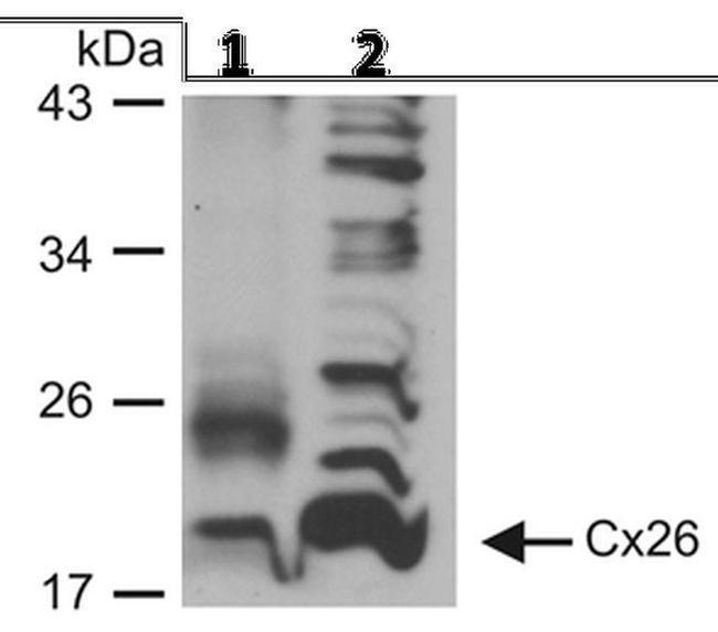 Connexin 26 Antibody in Western Blot (WB)