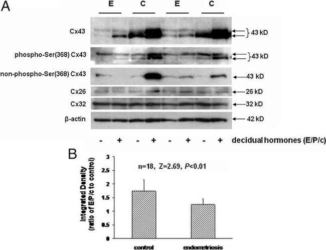 Connexin 26 Antibody in Western Blot (WB)