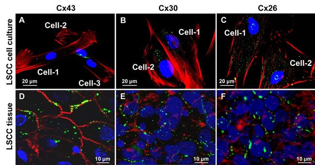 Connexin 26 Antibody in Immunocytochemistry (ICC/IF)