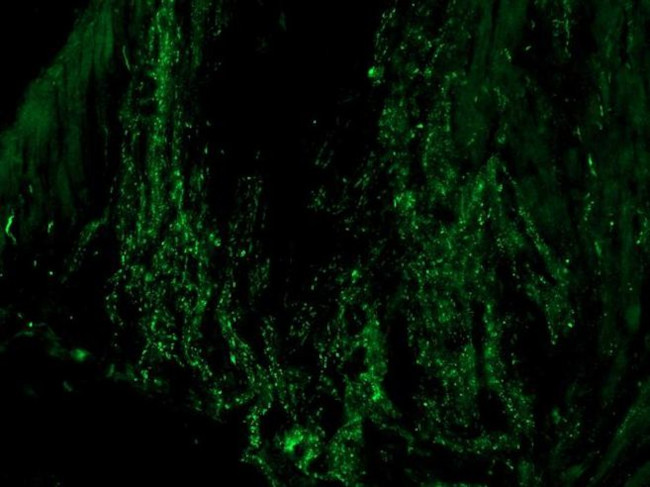 Connexin 30.2 Antibody in Immunohistochemistry (IHC)