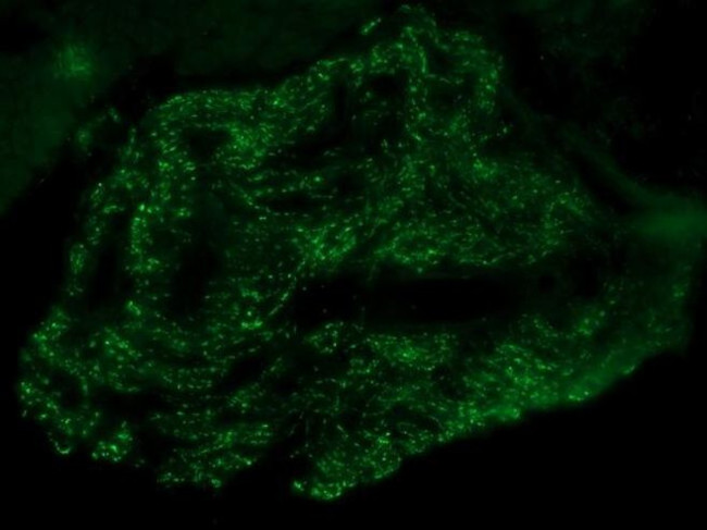 Connexin 30.2 Antibody in Immunohistochemistry (IHC)