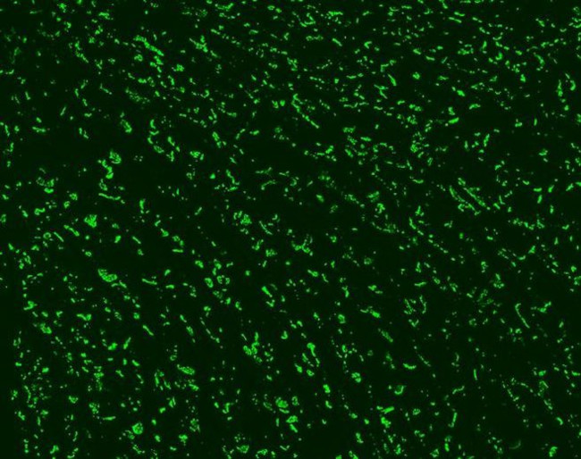 Connexin 43 Antibody in Immunohistochemistry (IHC)