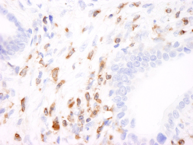 Coronin 1 Antibody in Immunohistochemistry (IHC)