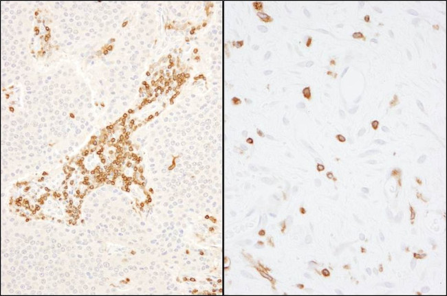 Coronin 1 Antibody in Immunohistochemistry (IHC)