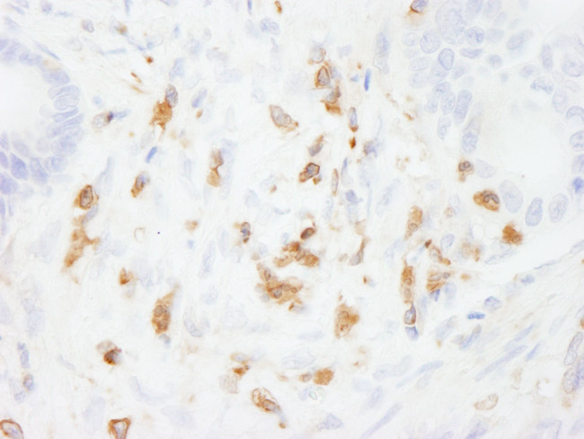 Coronin 1 Antibody in Immunohistochemistry (IHC)