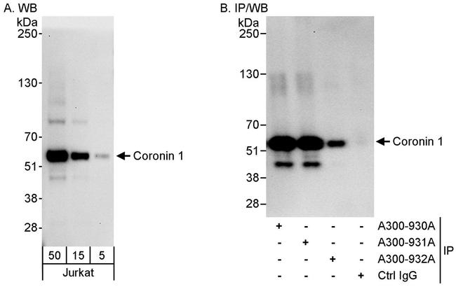 Coronin 1 Antibody in Western Blot (WB)