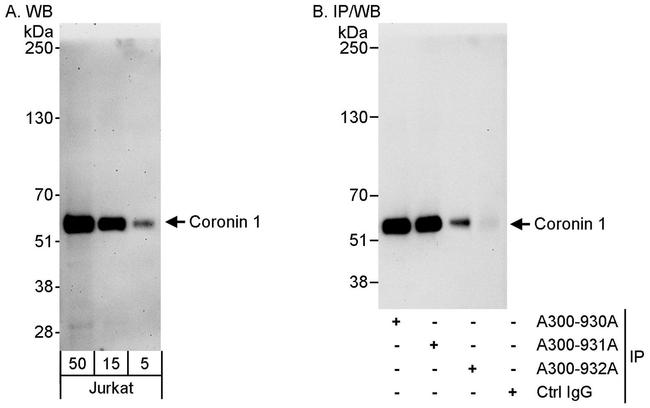 Coronin 1 Antibody in Western Blot (WB)