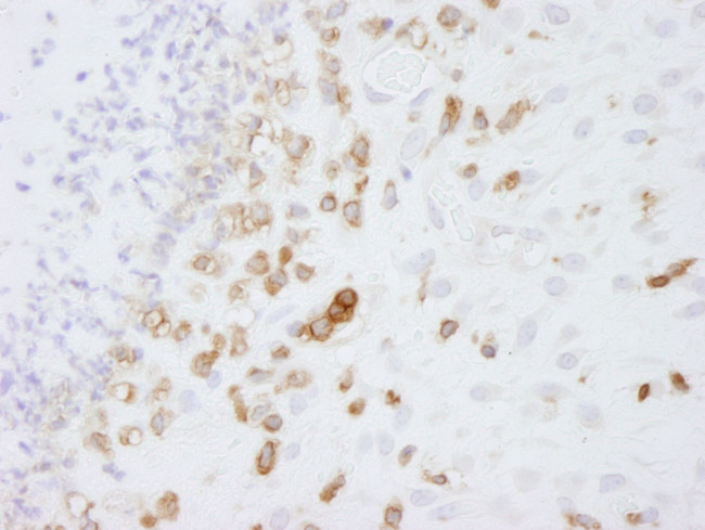 Coronin 1 Antibody in Immunohistochemistry (IHC)