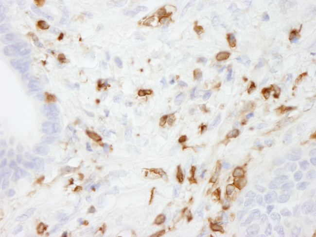 Coronin 1 Antibody in Immunohistochemistry (IHC)