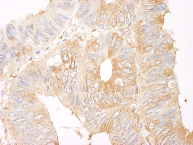 Coronin 2 Antibody in Immunohistochemistry (IHC)