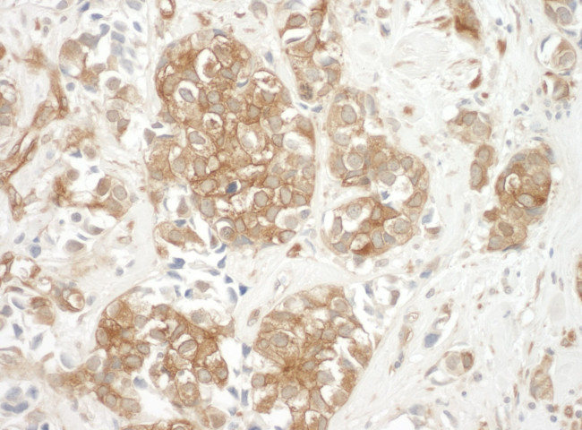 Cortactin Antibody in Immunohistochemistry (IHC)