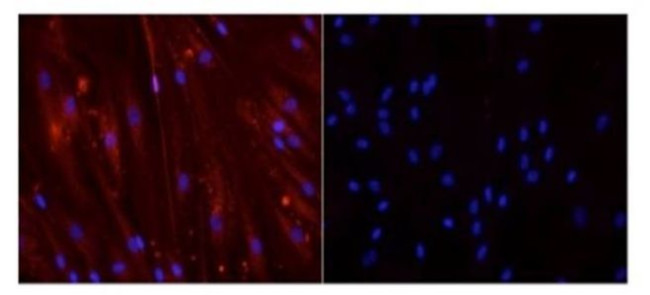 Myogenin Antibody in Immunocytochemistry (ICC/IF)