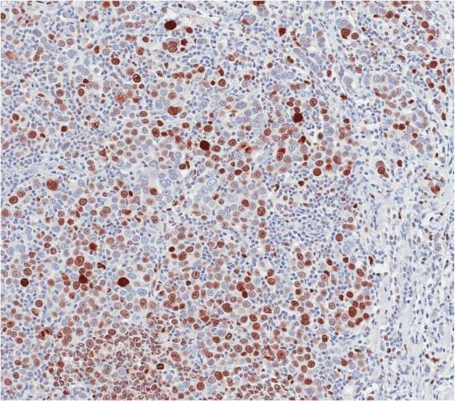 Ki-67 Antibody in Immunohistochemistry (Paraffin) (IHC (P))