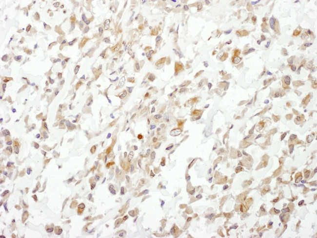 Cul1 Antibody in Immunohistochemistry (IHC)