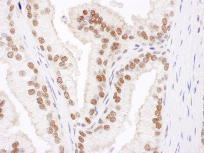 Cul4B Antibody in Immunohistochemistry (IHC)