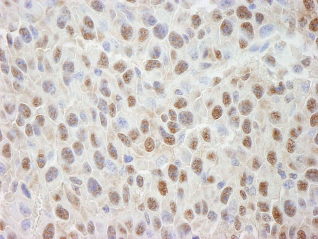 Cul4a Antibody in Immunohistochemistry (IHC)