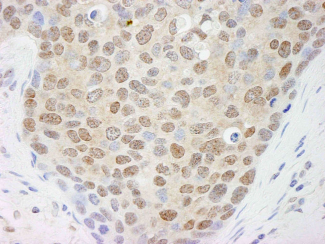 Cul4a Antibody in Immunohistochemistry (IHC)