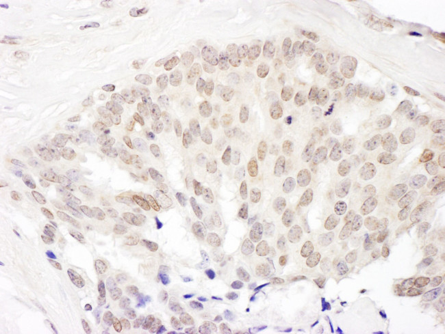 Cul5 Antibody in Immunohistochemistry (IHC)