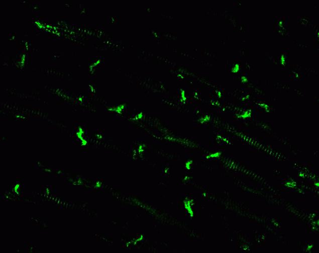 Connexin 30.2 Antibody in Immunohistochemistry (IHC)