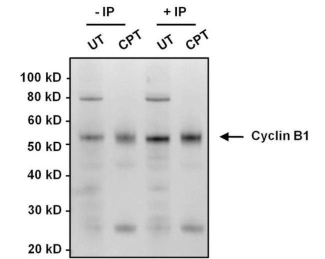 Cyclin B1 Antibody in Immunoprecipitation (IP)