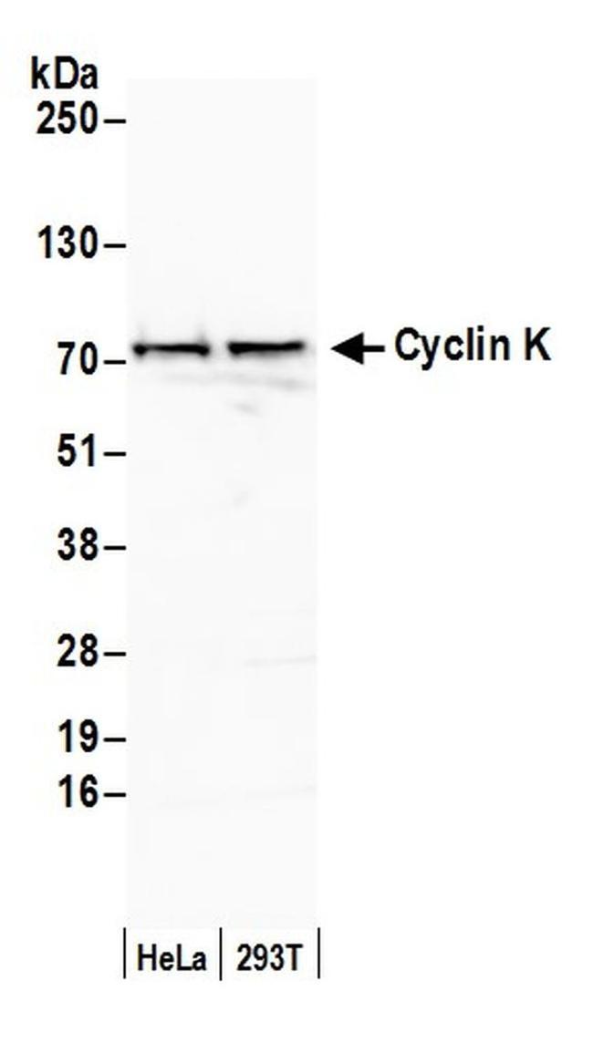 Cyclin K Antibody in Western Blot (WB)