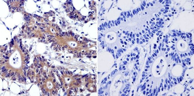 Cytohesin 2 Antibody in Immunohistochemistry (Paraffin) (IHC (P))