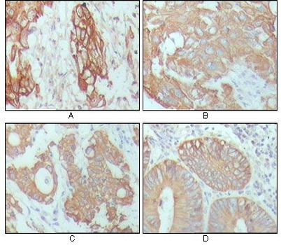 Cytokeratin 18 Antibody in Immunohistochemistry (Paraffin) (IHC (P))