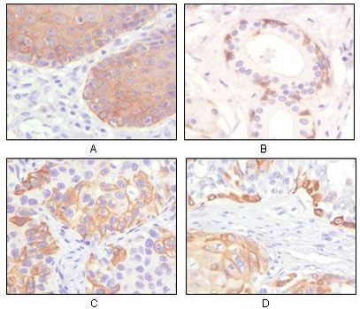 Cytokeratin 5 Antibody in Immunohistochemistry (Paraffin) (IHC (P))