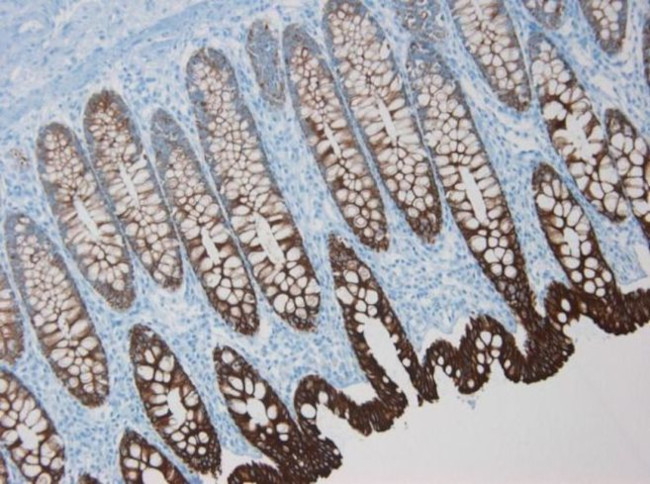 Cytokeratin 8 Antibody in Immunohistochemistry (Paraffin) (IHC (P))