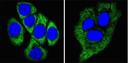 Cytokeratin 8 Antibody in Immunocytochemistry (ICC/IF)