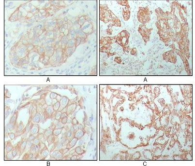 Cytokeratin 8 Antibody in Immunohistochemistry (Paraffin) (IHC (P))